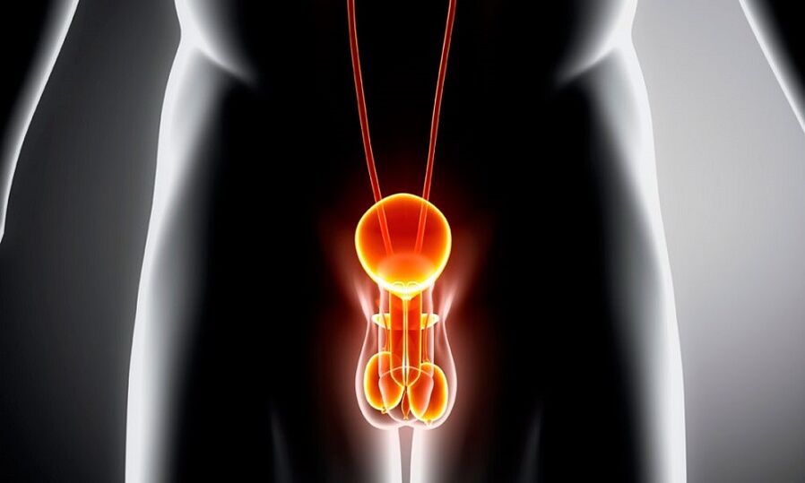 Geniturina infiammata per prostatite